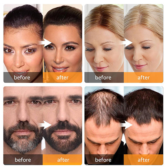 Root Cover Up Conceal Hair Loss for Women and Men